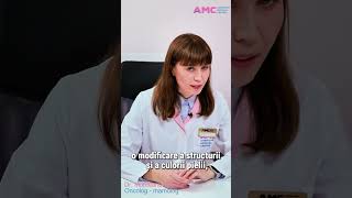 Simptome de cancer mamar  medicul Munteanu Viorica de la AMC Moldova [upl. by Iatnohs120]