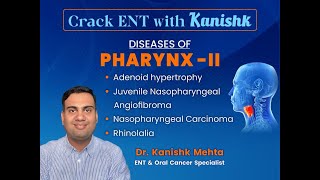 Diseases of Pharynx 2  Crack ENT with Kanishk  Angiofibroma  ENT Lectures  Dr Kanishk Mehta [upl. by Norreg]