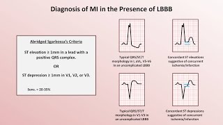 Intro to EKG Interpretation  Myocardial Infarctions Part 2 of 2 [upl. by Aivatnwahs512]