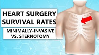 Surgeon QampA “Survival Rates of MinimallyInvasive Versus Sternotomy for Heart Valve Surgery” [upl. by Getraer945]