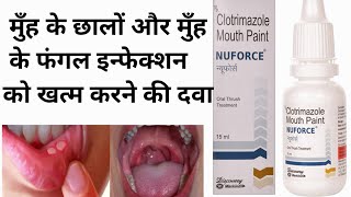 Nuforce Mouth Paint BenefitsClotrimazole Mouth PaintOral Fungul Infectionछाले व सफेद फफूंदshort [upl. by Maxim]