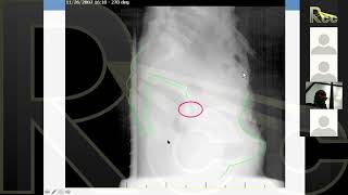 IMRT 20  Clinical Session 3  Decisions Pros and cons of IMRT [upl. by Nehcterg439]