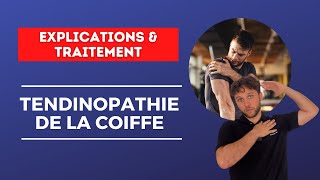 Nouvelles approches de rééducation pour une TENDINOPATHIE de la COIFFE  Explications amp traitement [upl. by Stephenson895]