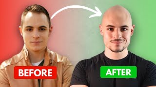 How Shaving My Head Restored My Confidence [upl. by Camilia]