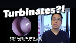 Inferior Turbinates what are they why do they swell stuffy nose congestion how do we treat [upl. by Vaenfila54]