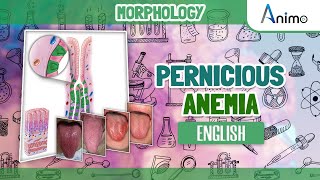 Pernicious Anemia  Histo pathology  RBC Morphology  English [upl. by Jacquetta509]