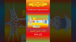 The Wallerian Degeneration 2 The New Pathophysiology [upl. by Eneleoj641]