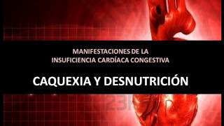 Insuficiencia cardíaca congestiva  Caquexia y desnutrición [upl. by Anitahs]