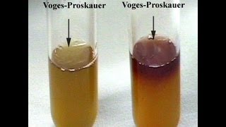 VogesProskauer Test  Amrita University [upl. by Edge]