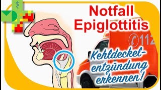 Epiglottitis  Kehldeckelentzündung erkennen und richtig reagieren [upl. by Charleton815]