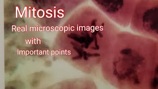 Mitosis  Real microscope image cell division with important points [upl. by Aneetak]