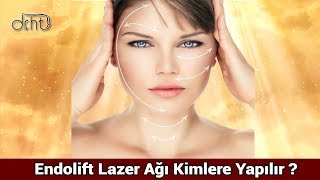 ENDOLİFT LAZER AĞI KİMLERE YAPILIR [upl. by Asial439]