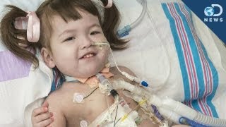 Stem Cell Tracheal Transplant Saves Girls Life [upl. by Caldwell]