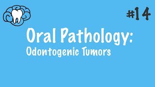 Oral Pathology  Odontogenic Tumors  INBDE ADAT [upl. by Wilber]