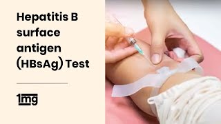 Hepatitis B surface antigen HBsAg Test  1mg [upl. by Tifanie540]