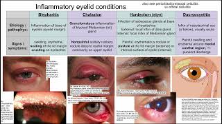 Inflammatory eyelid conditions [upl. by Aidualk]