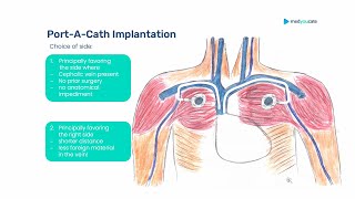 Peripheral amp Central Venous Access  CVC PortACath Hickman amp Co [upl. by Odareg]