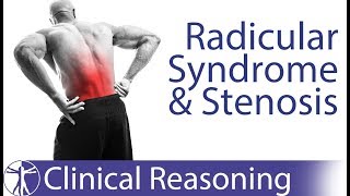 Lumbar Radicular Syndrome vs Intermittent Neurogenic ClaudicationStenosis [upl. by Riek848]