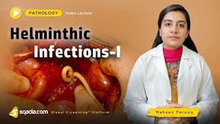 Helminthic Infections  Pathology Course  Medical Education  VLearning  sqadiacom [upl. by Mazur]