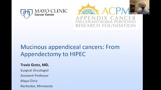 Mucinous Appendiceal Cancers from Appendectomy to HIPEC Dr Grotz Surgical OncologistMayo Clinic [upl. by Coriss91]