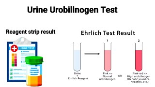 Ehrlich Aldehyde test  Test for detection of Urobilinogen in urine [upl. by Anairotciv]