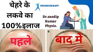 Bells palsy physiotherapy mohaniya kaimurdistrict facial exercises [upl. by Aronael]