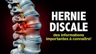 Hernie discale des informations importantes à connaître [upl. by Gerta99]