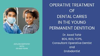 Chapter 9  OPERATIVE TREATMENT OF DENTAL CARIES IN THE YOUNG PERMANENT DENTITION [upl. by Aelrac496]