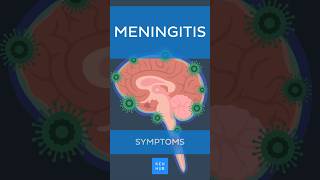 Meningitis Symptoms  Kenhub meningitis [upl. by Ngo]