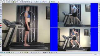 Running gait analysis Anteriorposterior pelvic tiltingwmv [upl. by Airamasor]