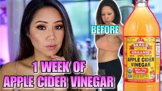 APPLE CIDER VINEGAR WEIGHT LOSS RESULTS  DRINKING APPLE CIDER VINEGAR FOR WEIGHT LOSS [upl. by Beauvais]