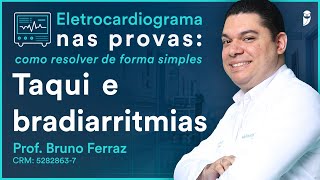 Taqui e bradiarritmias  Eletrocardiograma [upl. by Annoeik]