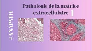 ANAPATH  pathologie de la matrice extracellulaire  partie 1 [upl. by Adler]