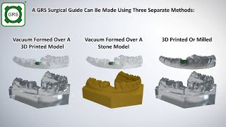 GRS Guide System  Dental Implant Surgical Guide Fabrication Techniques [upl. by Enirehs]