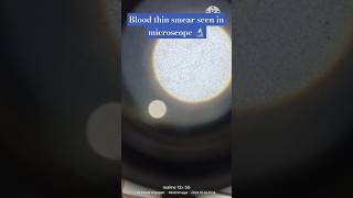 Blood microscopic test microscopebloodsliderbcwbcplateletspalamujharkhandpathologymltbmlt [upl. by Owens]