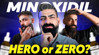 Minoxidil Beard Growth Pros and Cons  Honest Review  Rahul Badesra Hindi [upl. by Judas869]