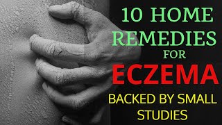 10 Home Remedies for Eczema Backed by Small Scientific Studies [upl. by Atiana138]