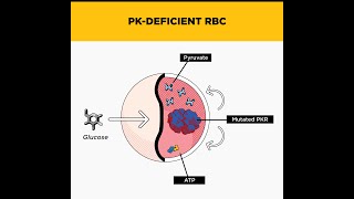 Phosphoglycerate Kinase Deficiency as a Disorder related to Glycolysis Pathway [upl. by Llert]