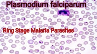 Plasmodium falciparum under microscope [upl. by Mirielle]