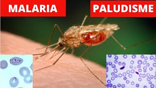 LE PALUDISME MALARIA  Tout ce que vous devez savoir [upl. by Nicole]