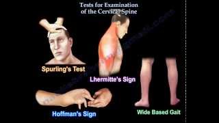 Tests For Examination Of The Cervical Spine  Everything You Need To Know  Dr Nabil Ebraheim [upl. by Enomes]