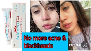 How to use Tretinoin  Skincare products Layer step by step skincare tretinoin [upl. by Elatsyrc]