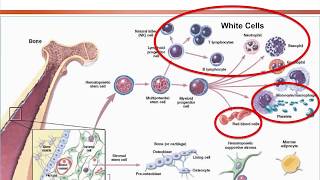 Aplastic Anemia Approach on Diagnosis and Treatment Options 2018 [upl. by Kelcy81]