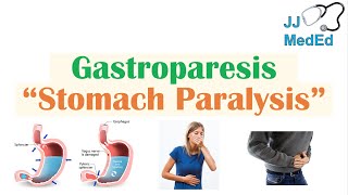 Gastroparesis Stomach Paralysis  Causes and Risk Factors Signs amp Symptoms Diagnosis Treatment [upl. by Sparke]