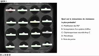 Lecture interprétative de l’antibiogramme de Pseudomonas aeruginosa [upl. by Sirrep]