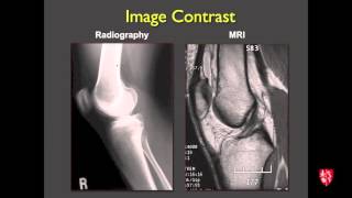 Medical Student Lecture Introduction to Musculoskeletal Imaging [upl. by Osman]