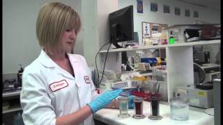 Preparing and Staining Blood Film [upl. by Northrup]