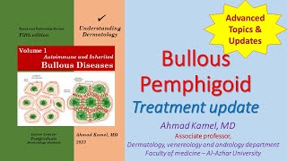 Bullous Pemphigoid Treatment update [upl. by Three]