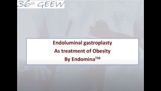 Endoluminal gastroplasty as treatment of obesity by Endomina™ [upl. by Alexandre675]