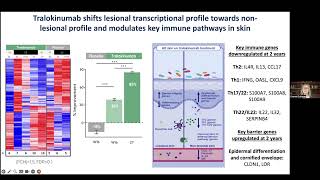 Dr GuttmanTargeing IL13 with tralokinumab normalizes type 2 inflammation in AD [upl. by Eylrahc]